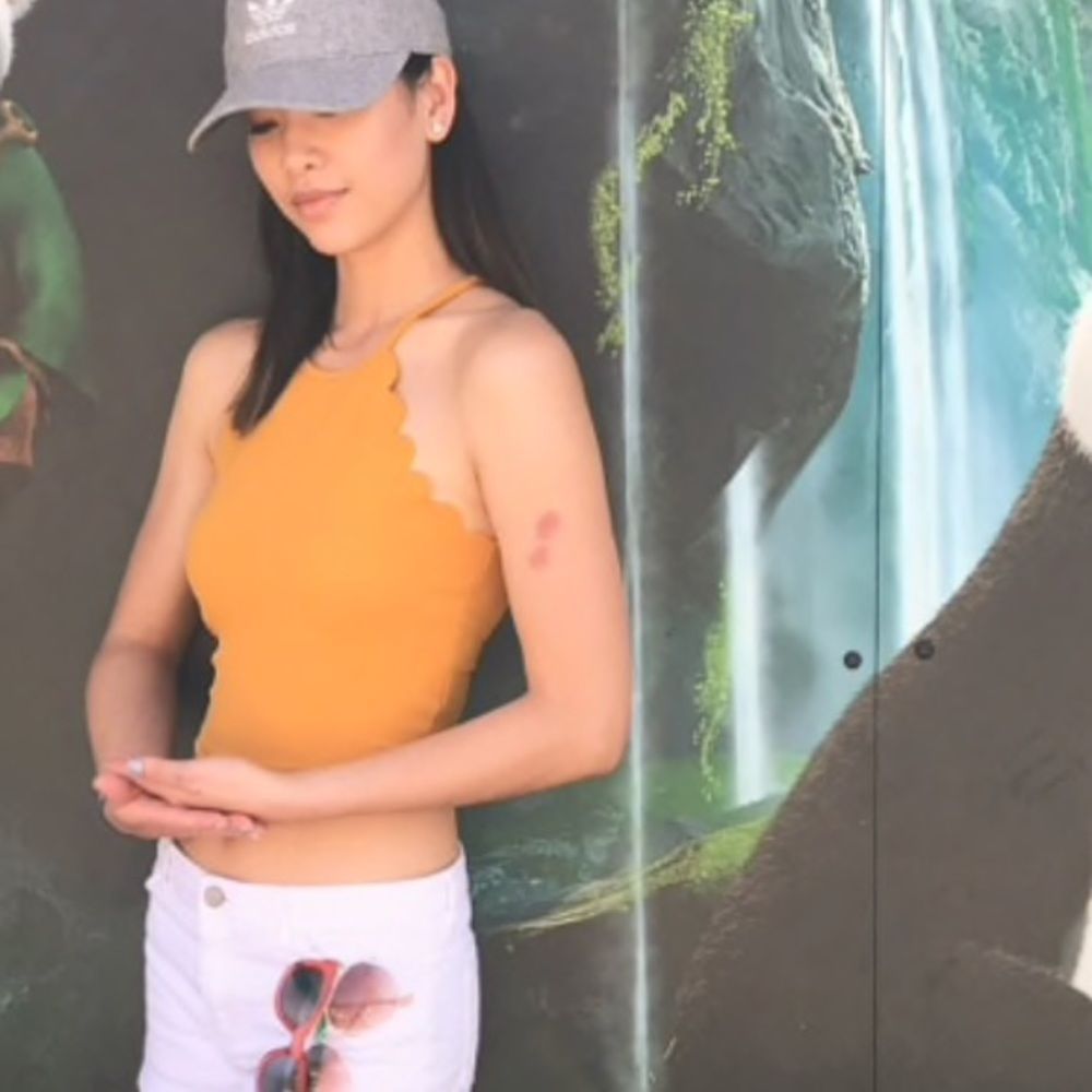 Mustard Scalloped Crop Top